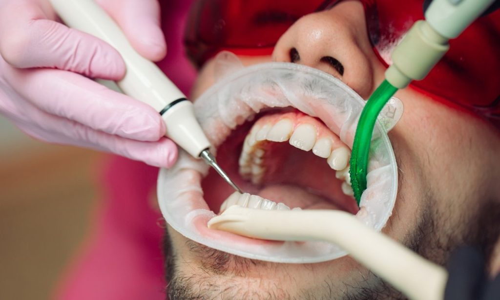 How to Relieve Pain After Teeth Cleaning